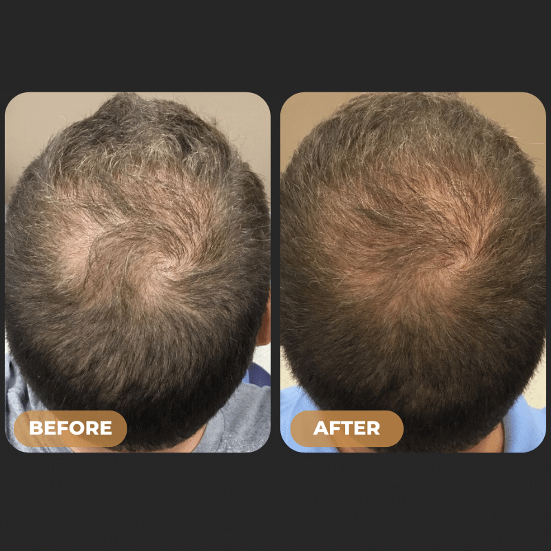 SPARTAN - Root Activator Conditioner