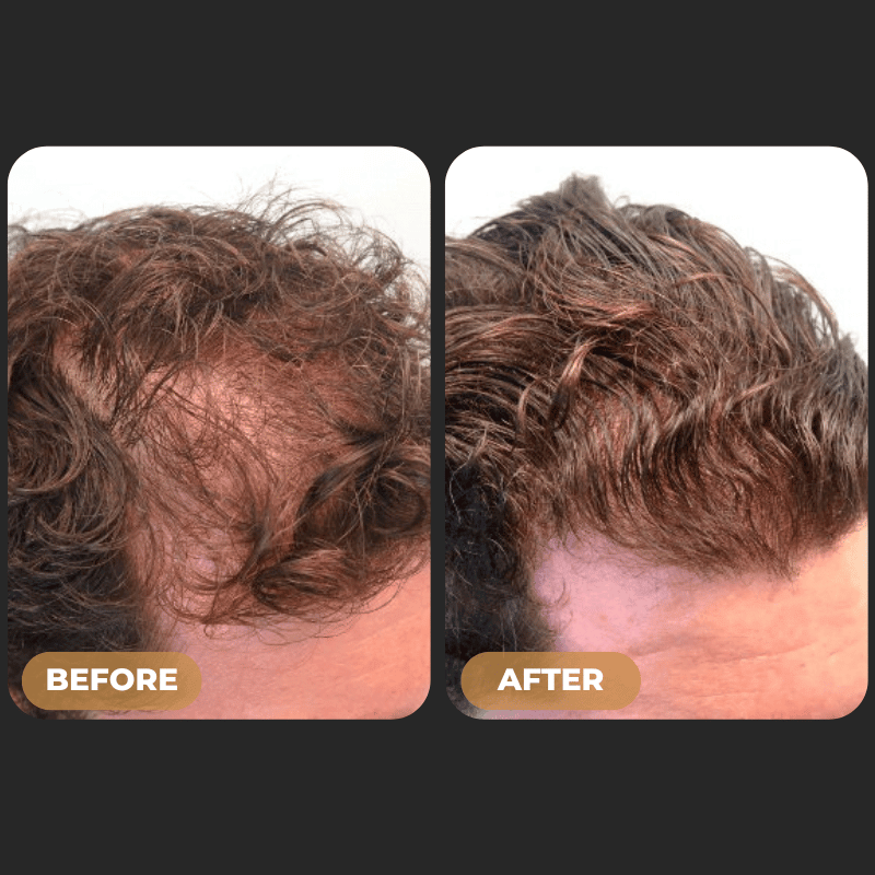 SPARTAN - Root Activator Conditioner